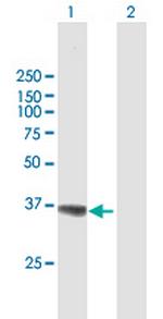 AKR1A1 Antibody in Western Blot (WB)