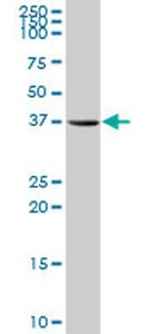 AKR1A1 Antibody in Western Blot (WB)