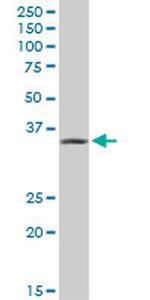 AKR1A1 Antibody in Western Blot (WB)