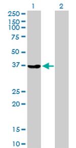 AKR1A1 Antibody in Western Blot (WB)