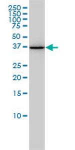 AKR1A1 Antibody in Western Blot (WB)