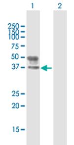 B3GNT3 Antibody in Western Blot (WB)