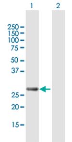 PCGF3 Antibody in Western Blot (WB)