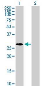 NPM2 Antibody in Western Blot (WB)