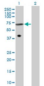 TUBB3 Antibody in Western Blot (WB)