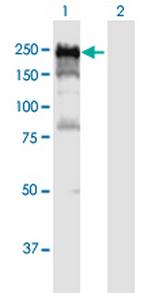 DLC1 Antibody in Western Blot (WB)