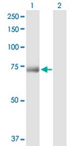 PRMT5 Antibody in Western Blot (WB)