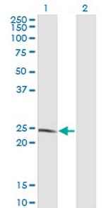 LYPLA1 Antibody in Western Blot (WB)