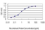 ACAA2 Antibody in ELISA (ELISA)