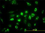 ACAA2 Antibody in Immunocytochemistry (ICC/IF)