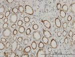 ACAA2 Antibody in Immunohistochemistry (Paraffin) (IHC (P))