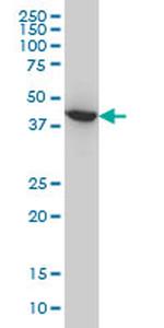 ACAA2 Antibody in Western Blot (WB)