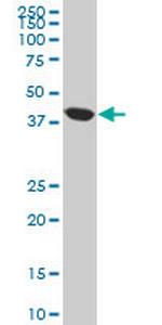 ACAA2 Antibody in Western Blot (WB)