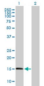 ZNHIT1 Antibody in Western Blot (WB)