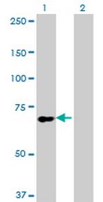 SLC9A6 Antibody in Western Blot (WB)