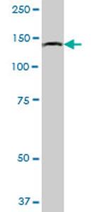 HYOU1 Antibody in Western Blot (WB)