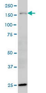 HYOU1 Antibody in Western Blot (WB)