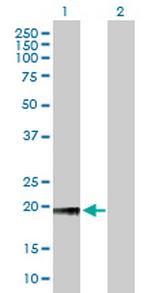 NOL5A Antibody in Western Blot (WB)