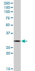 RNASEH2A Antibody in Western Blot (WB)