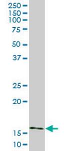 AGR2 Antibody in Western Blot (WB)