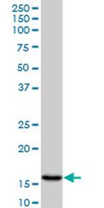 AGR2 Antibody in Western Blot (WB)