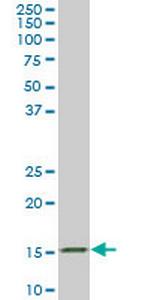 AGR2 Antibody in Western Blot (WB)