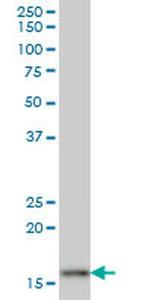 AGR2 Antibody in Western Blot (WB)