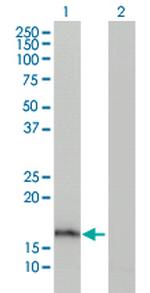 AGR2 Antibody in Western Blot (WB)