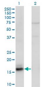 AGR2 Antibody in Western Blot (WB)