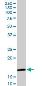 AGR2 Antibody in Western Blot (WB)