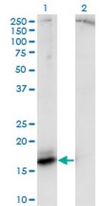 AGR2 Antibody in Western Blot (WB)