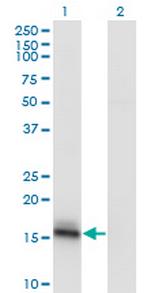 AGR2 Antibody in Western Blot (WB)