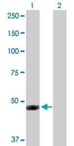 IFI44 Antibody in Western Blot (WB)