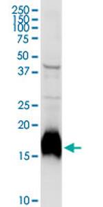 NPC2 Antibody in Western Blot (WB)