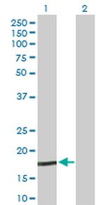 NPC2 Antibody in Western Blot (WB)