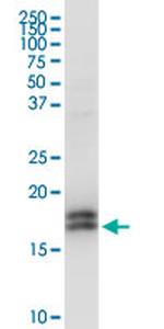 NPC2 Antibody in Western Blot (WB)