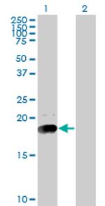 NPC2 Antibody in Western Blot (WB)