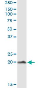 NPC2 Antibody in Immunoprecipitation (IP)