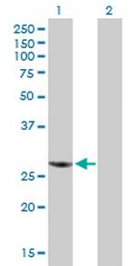 RBCK1 Antibody in Western Blot (WB)