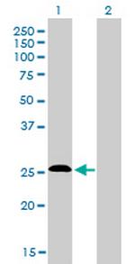 C20orf18 Antibody in Western Blot (WB)