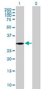 ARID3B Antibody in Western Blot (WB)