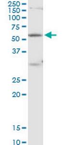 POLR3C Antibody in Western Blot (WB)