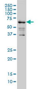 IGF2BP3 Antibody in Western Blot (WB)