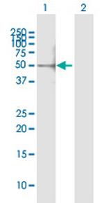 CUGBP1 Antibody in Western Blot (WB)