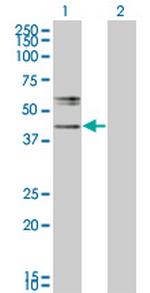 B3GNT2 Antibody in Western Blot (WB)