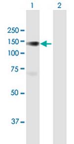 PLK4 Antibody in Western Blot (WB)