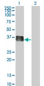 SIX2 Antibody in Western Blot (WB)