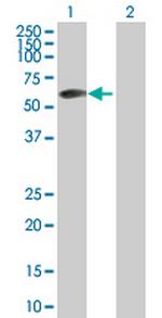 ZBTB6 Antibody in Western Blot (WB)