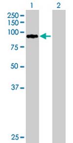 ZNF274 Antibody in Western Blot (WB)