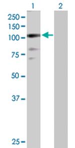 ZNF274 Antibody in Western Blot (WB)